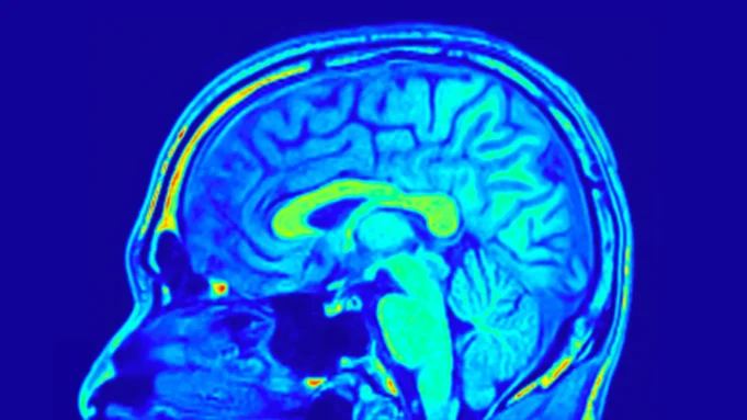 科學家發現了更強的大腦層。 科學家發現了更強的大腦層。