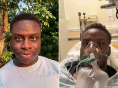 一名24歲男子認為胸痛是由於工作壓力造成的,隨後得到了休克診斷