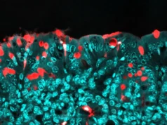 這種常見的食品成分可能會影響孩子的終生健康。