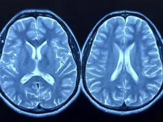 核磁共振掃描顯示,運動可以讓大腦看起來更年輕。