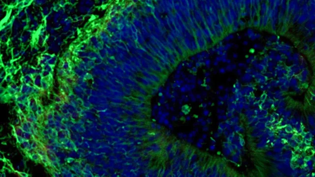 fluorescent-image-of-brain-organoid.webp.webp